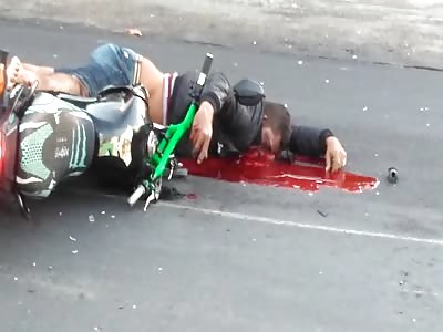 man dies drowned in his blood, after being run over with his bike