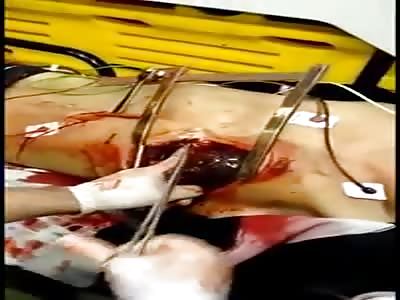  video 1 shocking :emergency tracheostomy 