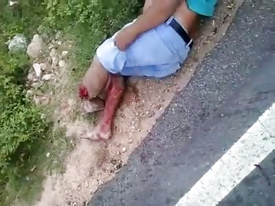 Accident  with bike 
