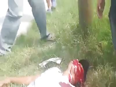 Protester vomits blood after he was shot by a police