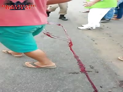 Foot crushed by truck in accident
