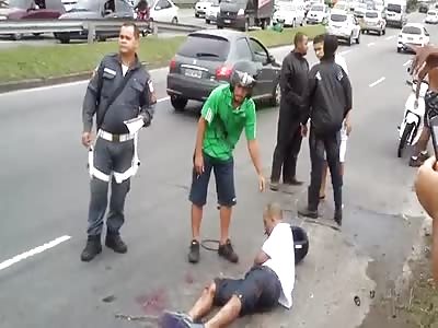 Road accident leaves man with no face