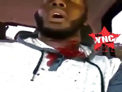 Man gets shot in the neck and immediately makes a live video on Instagram 