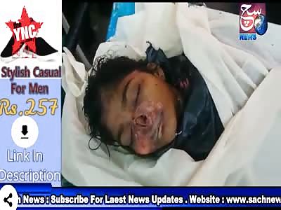 Dead Body Eaten By Rats In Osmania Hospital Hyderabad