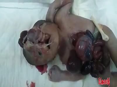A baby in terrible condition