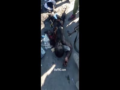 Calcined and dismembered corpses members of DAESH
