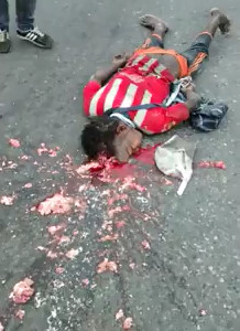 Man With Destroyed Skull after a Deadly Meeting with the Street