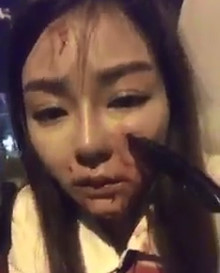  Knife in Face fails to kill stabbed Chinese Girl