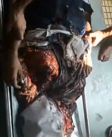 GRAPHIC: AFTERMATH: Man Commits Suicide by Jumping in Front of fast Moving Train.
