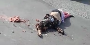 Horrific Accident Destroyed a Woman's Head 