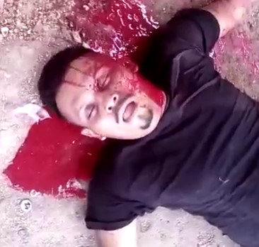 Man Takes last Breath and Dies with Disturbing Facial Expression