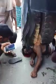 Indian Man Lives with Truck on His Crushed Head