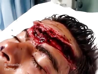 Horrible wound on the man's forehead