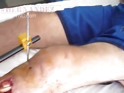 Leg of man with nails