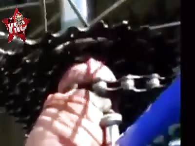 Wtf man gets his penis on a bicycle chain