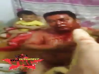 Man is beaten up to bleed part 1