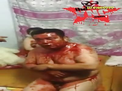 Man is beaten up to bleed part 2