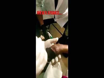 Doctors debride woman's black rotting hand.