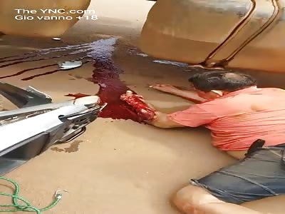 Man in agony with Arm Crushed Traffic accident