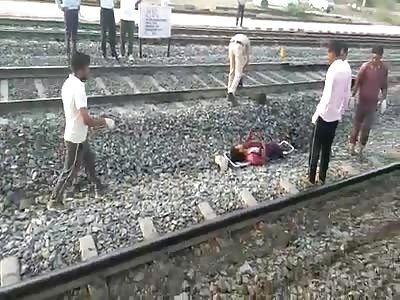 Giving woman in shock her lost limb after train accident