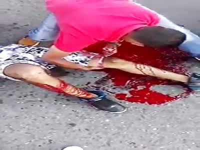 Man losing a lot of blood after accident