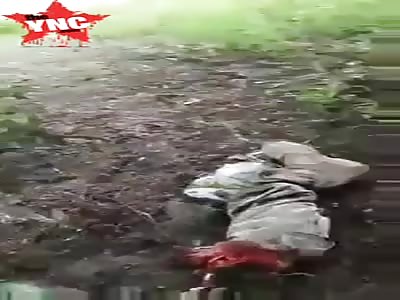Bikers severed leg lies on other side of the street after accident
