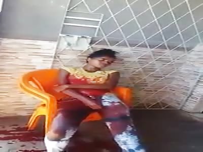 Girl covered in blood after being shot