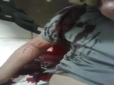 Man with blood pouring out of his head after being fatally shot 
