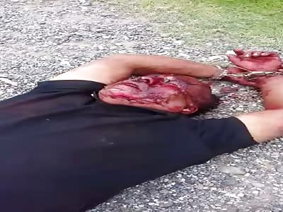 Man found bloodied bruised + handcuffed