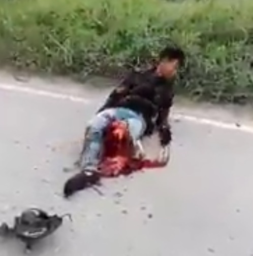 Man Agonizing With Leg Torn to Shreds From Accident