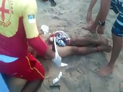  Damn! Young Man Dying With Balls Ripped Open by Shark in Recife, Brazil