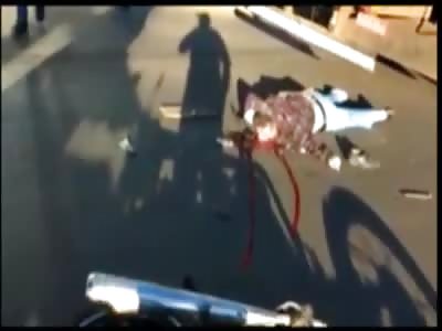 Brazil Biker With Crushed Head