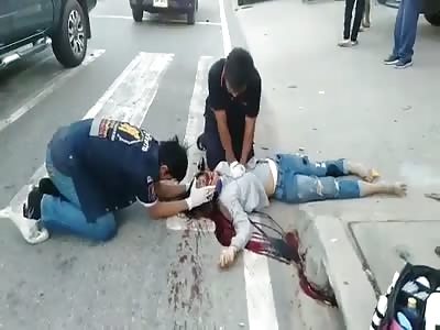 Accident With Female Biker
