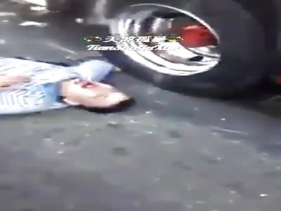Bikers Arm Crushed under a Bus