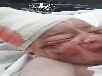 Injured baby victim of Russian attacks