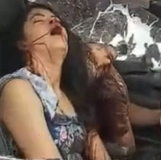 Woman in Total Agony FUCKED up From Accident 