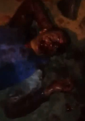 Bleeder Falls Fucked Up After Machete Attack