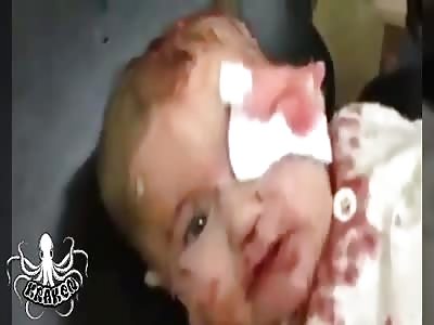 Baby victim of Russian bombing