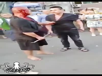 consequence of brutal street fight