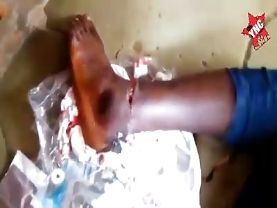 Nigerian civilian with gunshot wounds
