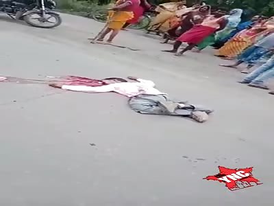shocking accident, man with crushed head