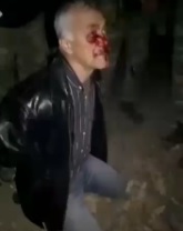 Old Man Beaten by Azerbaijani Troops.