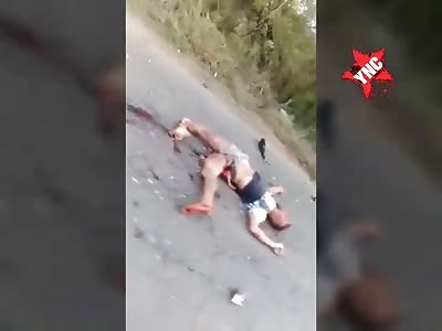Motorcycle accident victim