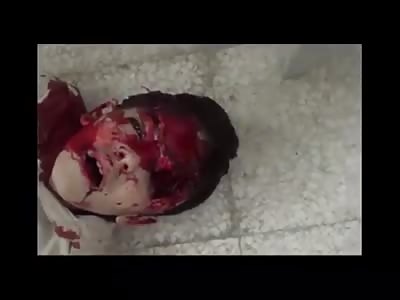 Syrian boy brutally murdered during the war