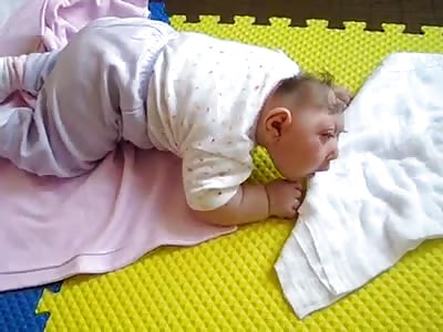 Strong video not suitable for sensitive. Baby with malformation in the head
