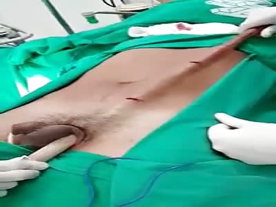 WTF!!!! removal of a tube that goes through a person's entire body,