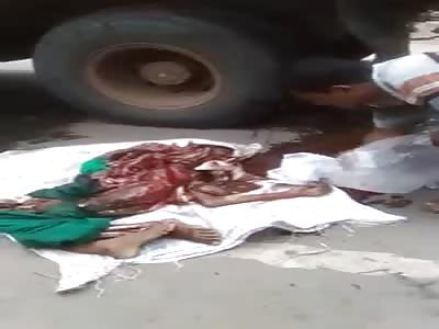 True Gore.. Boy Run over by Something Heavy is Nothing but Guts Now 
