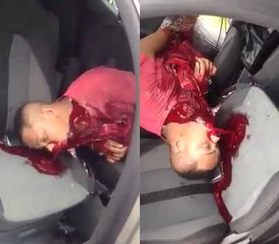 DISTURBING: After Being Shot in His Car (Other Angle)