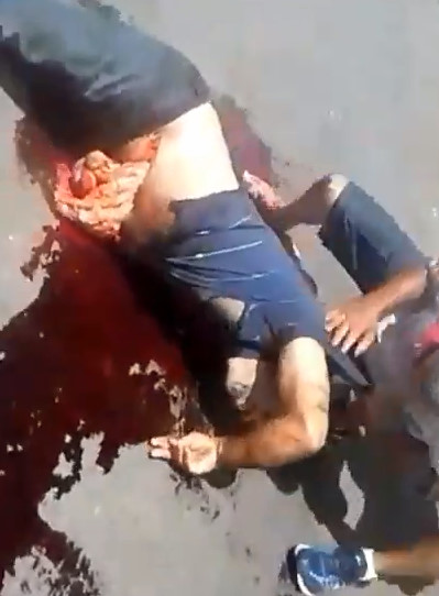 [Full Video] Man Trying to Hang on With his Guts Hanging Out after stabbed 