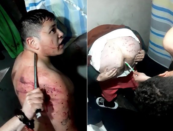 Chilean Inmate Beaten , Stabbed and Sodomized [FULL VIDEO]